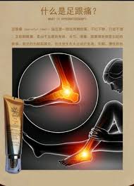 睡醒足跟痛不红不肿就是行走不方便那是因为骨质关节滑囊筋膜等处病变引起的疾病 sensebiocream 非常有效解决足跟痛