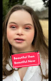 Grace Then and Now: Beautiful Transformation