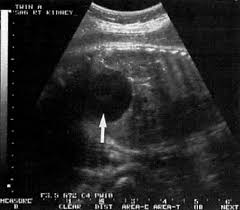 Awesome anomaly detection what is anomaly detection? Ultrasound Diagnosis Of Fetal Anomalies Glowm