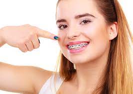 The elastics put pressure on the jaw and help move both teeth and draw to more correct positioning. Uncategorized