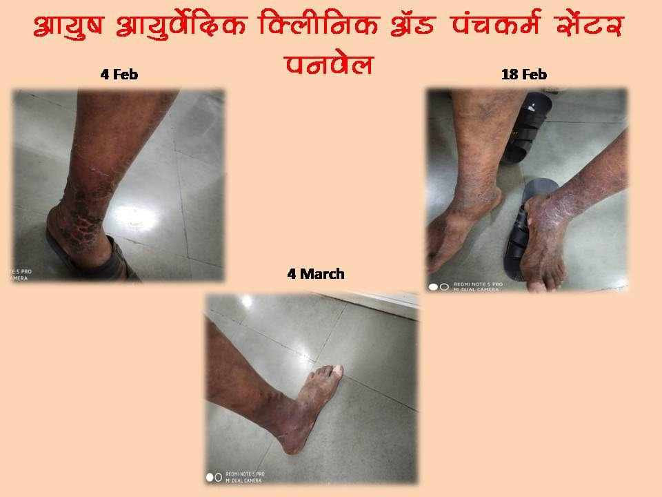skin disease treatment flat 30 % off product image