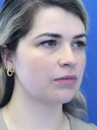 Cases in COSMETIC SURGICAL