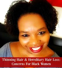 It may depend on your age. Thinning Hair Hereditary Hair Loss Concerns For Black Women Seriously Natural