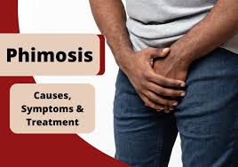 Image result for Phimosis