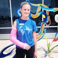 Image result for Long Arm Cast