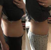 Bauch 8 Ssw Forum Schwangerschaft Urbia De