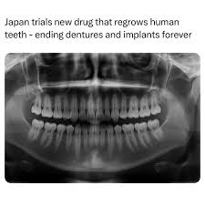 Japan Trails New Treatment for Tooth Regrowth - End of Dentures and  Implants?