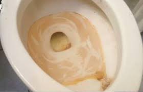 Maybe you would like to learn more about one of these? How To Remove Stubborn Hard Water Brown Stains From Toilet Bowls Rings Sediments Toiletseek