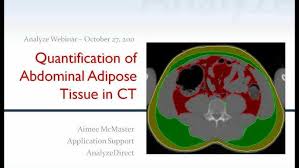 Quantification of Abdominal Adipose Tissue from CT using Analyze 10.0
