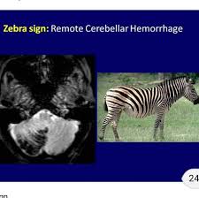 Pin By Jorge Medbar On Radiology Medical Studies Radiology Medicine Studies