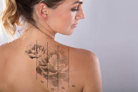 In contrast, the most vibrant colours such as hot pink, yellow, light green tend to fade faster. How To Lighten A Tattoo Naturally Without Pain Lovetoknow