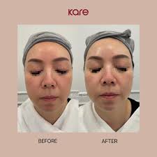 韓國Glosome院線限定護理🇰🇷登陸澳門·  Glosome是來自的韓國天然生活方式品牌，採用最接近99.99%天然植物成分製成，安全又有功效。品牌不使用化學原料、不含動物試驗和成分，並與韓國大師級藝術家合作，是結合尊重生態和生活儀式的品牌。很多韓流明星及網絡紅人都有推薦此  ...