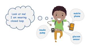 Hør oslomets podkast om sammenhengen mellom blodsukker og diabetes. Looping I Danmark Kom Igang Nu Type1 Dk