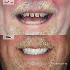 Michigan Dental Implant Studio