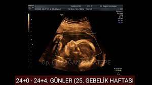 24 haftalik 5 5 aylik gebelikte kiz bebek nasil gorunur renkli doppler bebek doktorlar