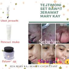 Srt ni baru launch bulan july 2017 lepas. Tips Kecantikan Mary Kay Rawat Masalah Jerawat Dengan Mary Kay