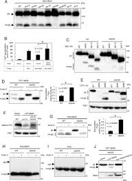 We are in a different space with vaccination and as a small open economy aviation is. The Er Associated Protease Ste24 Prevents N Terminal Signal Peptide Independent Translocation Into The Endoplasmic Reticulum In Saccharomyces Cerevisiae Journal Of Biological Chemistry
