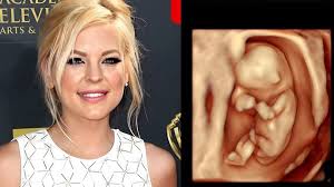 I may have missed something. Where is Spinelli?