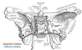 Learn all about its anatomy, openings, borders and development at kenhub. Limbus Sphenoidale Radiology Reference Article Radiopaedia Org