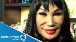 Lyn may presumió cómo quedó su rostro tras un nuevo tratamiento estético, pero antes su aspecto. Lyn May Revela Ser Amante De Un Presidente Youtube
