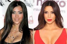Kim Kardashian Plastic Surgery Gone Wrong Celebrity Plastic Surgery Gone Wrong Kim Kardashian Before After