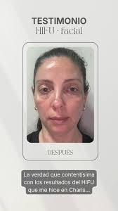 ✨ ¡Nuevas incorporaciones en VC Estética Integral! ✨ Le damos la bienvenida  a Mariela, Cosmiatra y propietaria de Queen Centro de bellezay Spa en  Rafaela, quien se suma a nuestro equipo 💆‍♀️💫