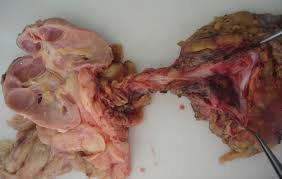 Image result for Genitourinary Tuberculosis