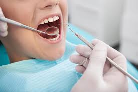 Los Angeles Dentist Oral Surgery Emergency Dentist Dentist Dentistry