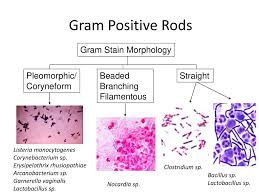 This pathogen is the only gram positive bacterium that produces endotoxin. The Gram Positive Rods And Aerobic Actinomycetes Ppt Download
