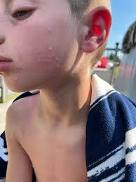 Many thanks to Tenby Cottage Hospital for sorting my hubby's nasty spider  bite out today! What an amazing place!