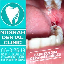 Meski sudah cukup kuat, ternyata makanan. Skdh1ilgibqpdm