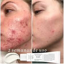 Dr. Althea 345 - Relief Cream para piel sensible, con tendencia de acn – Mi  tienda