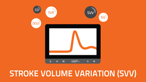 Checking stroke volume requires invasive technique. Understanding Stroke Volume Variation Svv Lidco Hemodynamic Monitoring For The Entire Patient Pathway