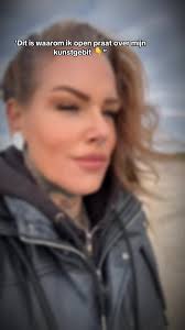 Waarom openhartig praten over kunstgebit belangrijk is