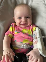 Is a deep portacath placement causing fever and tachycardia in children?