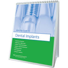 ada flip guide to dental implants w483