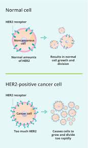How long is herceptin given? How Does Perjeta Pertuzumab Treat Her2 Breast Cancer