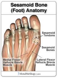 Sesamoiditis