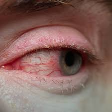 Image result for Blepharis bainesii