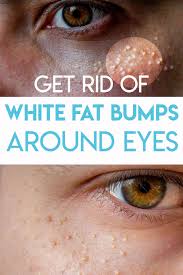 This Cream Helps Rid You Of Eye Puffiness And Dark Circles Firming Eye Cream Bumps Under Eyes Fight Dry Skin