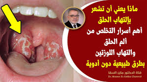 التهاب الحلق، هي واحدة من الشكاوى الاكثر شيوعا. Ø³Ø±Ù…Ù† Ø£Ø³Ø±Ø§Ø±ØªÙ†Ø¸ÙŠÙ Ø§Ù„Ø­Ù„Ù‚ ÙˆØ§Ù„Ù‚Ø¶Ø§Ø¡ Ø¹Ù„Ù‰ Ø£Ù„Ù… ÙˆØ§Ù„ØªÙ‡Ø§Ø¨ Ø§Ù„Ø­Ù„Ù‚ Ø¨Ø¹Ù„Ø§Ø¬ ÙØ¹Ø§Ù„ ÙÙˆØ±ÙŠ ÙŠØ®Ù„ØµÙƒ Ù…Ù† Ø§Ù„ØªÙ‡Ø§Ø¨ Ø§Ù„Ù„ÙˆØ²ØªÙŠÙ† ÙˆØªØ¶Ø®Ù…Ù‡Ø§ Youtube