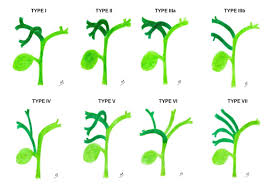 The anatomy of the biliary tree is notoriously variable. Epos C 3735