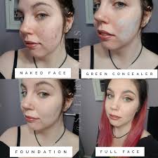 Can anyone recommend a concealer they used to hide post surgery bruises ? I  am Caucasian with fair skin. Thank you!