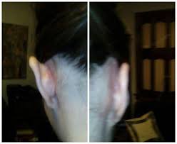 Ridenour Plastic Surgery, 12460 Olive Blvd, Ste 202, Saint Louis, MO 63141,  US