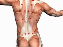 Pin On Dry Needling