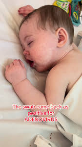 Adenovirus Awareness: Supporting Your Sick Child