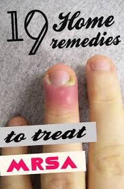 19 Home Remedies To Treat Mrsa Home Remedies Remedies Natural Antibiotics