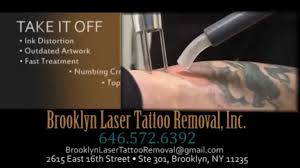 To have laser tattoo removal. Brooklyn Laser Tattoo Removal Inc Tattoo Removal Nyc 646 572 6392 Youtube