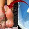 7 home remedies which will make your feet soft and beautiful in no time all natural home remedies. Https Encrypted Tbn0 Gstatic Com Images Q Tbn And9gcrdi4rjf3dwzpgmeehsjza5 2ehnuy46x4brzbk1axxxmrkxqc9 Usqp Cau