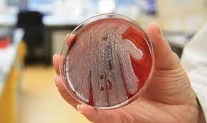 Pseudomonas aeruginosa is a type of germ that can cause infections in humans, mostly in hospital patients. Blick Hinter Die Kulissen Eines Kliniklabors Was Blut Urin Und Stuhl Verraten Rhein Lahn Zeitung Rhein Zeitung